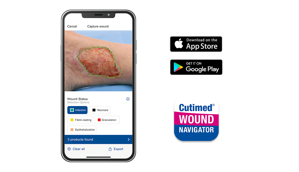 Abbildung zeigt die Wound Navigator App. Abbildung zeigt die Wound Navigator App.